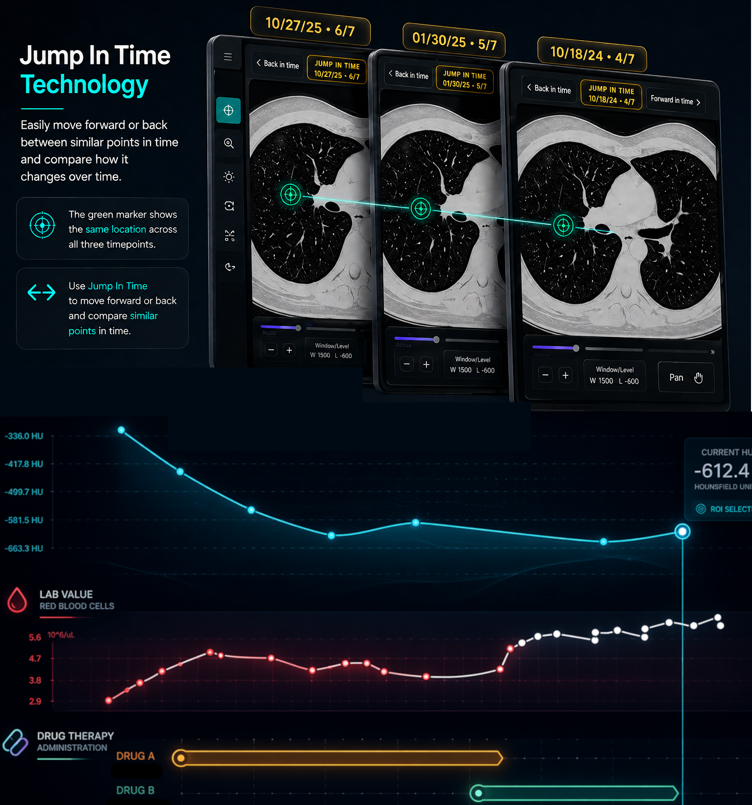 Longitudinal CT Jump in Time view