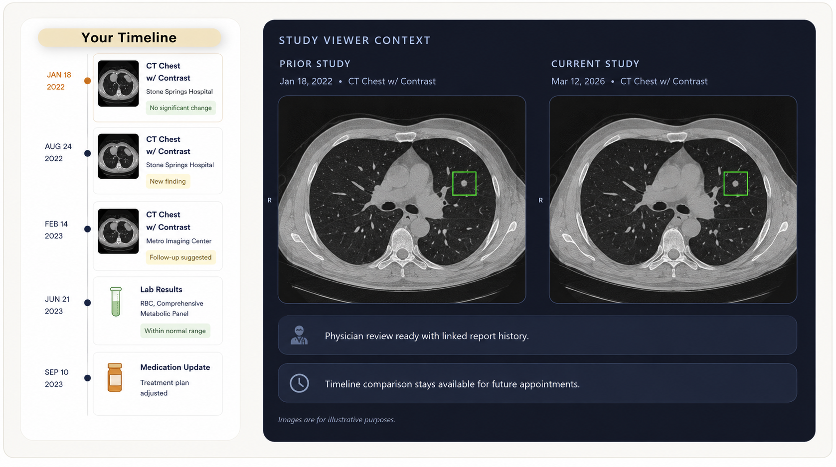 Timeline plus study viewer context showing prior and current scan comparison